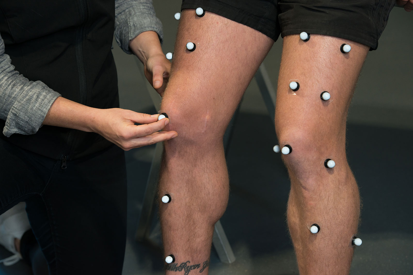 Runners knee